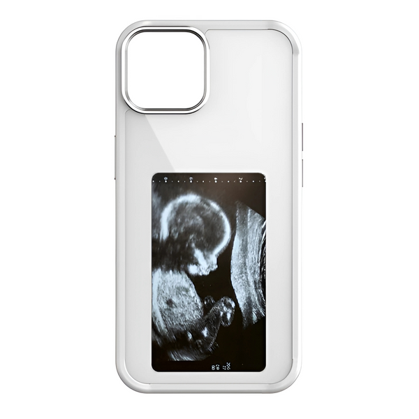 JA™ Snapframe E-ink Phone Case